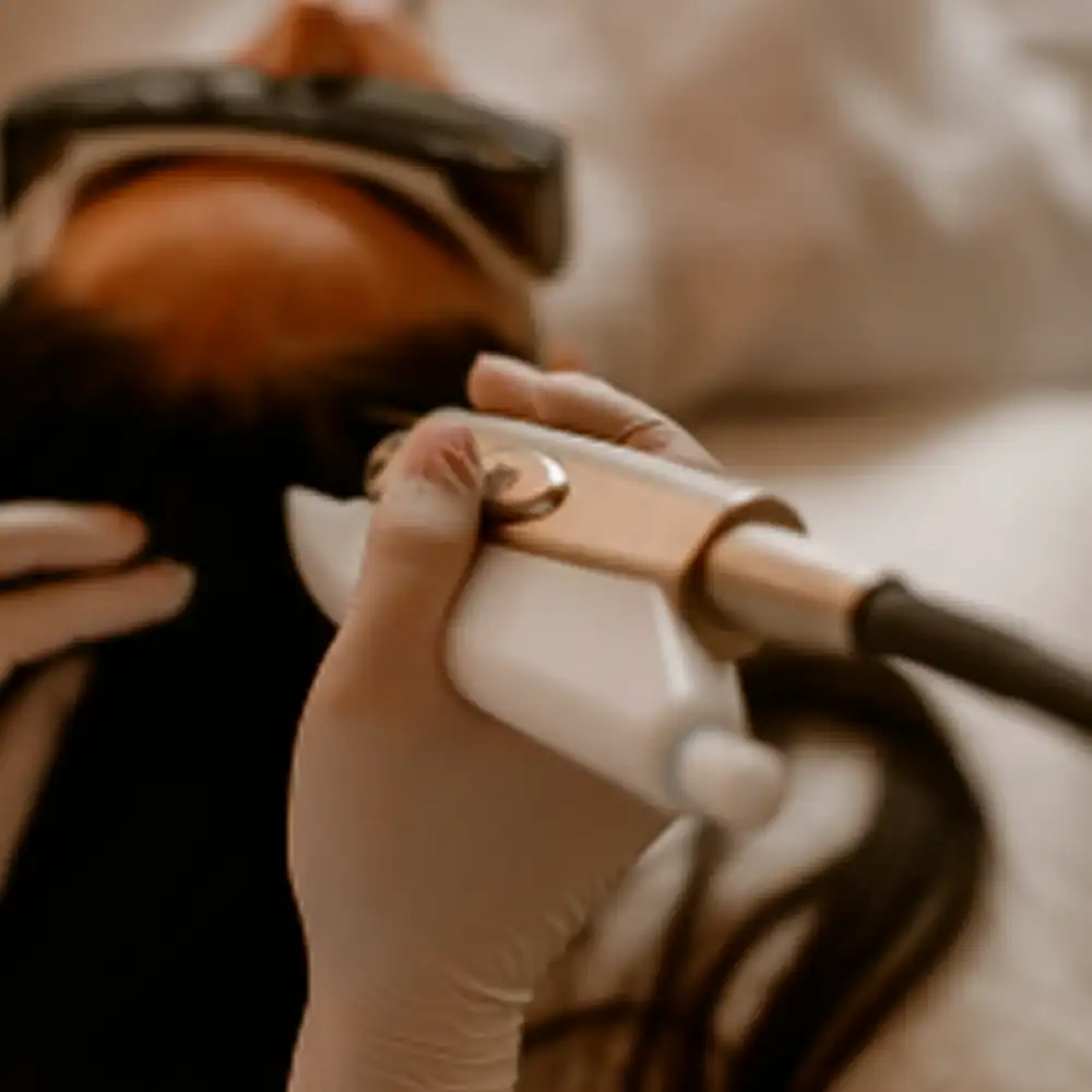 Close-up of a gloved hand holding a laser device over a person's forehead during a cosmetic procedure.